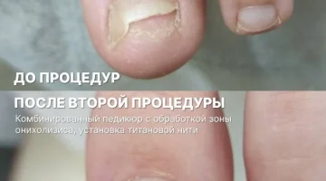 Центр медицинского педикюра, подологии, дерматологии и ортопедии PODOMASTER изображение 7